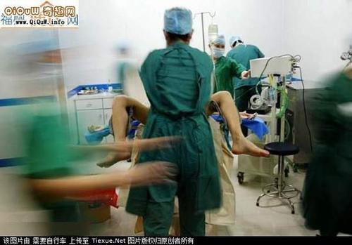 美女变性成男人手术