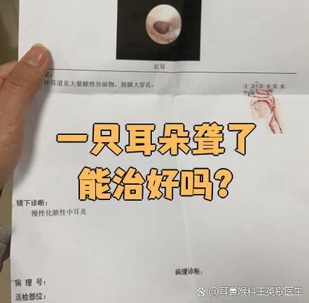 极重度耳朵聋可以治愈吗
