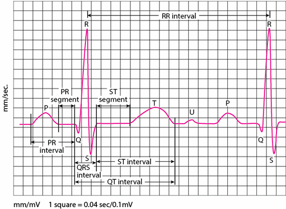 心电图异常ecg