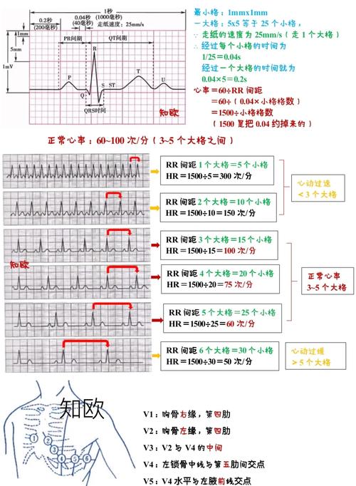 心电图的ecg是什么意思