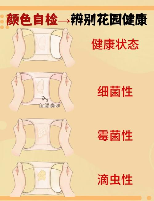 白带多是什么原因